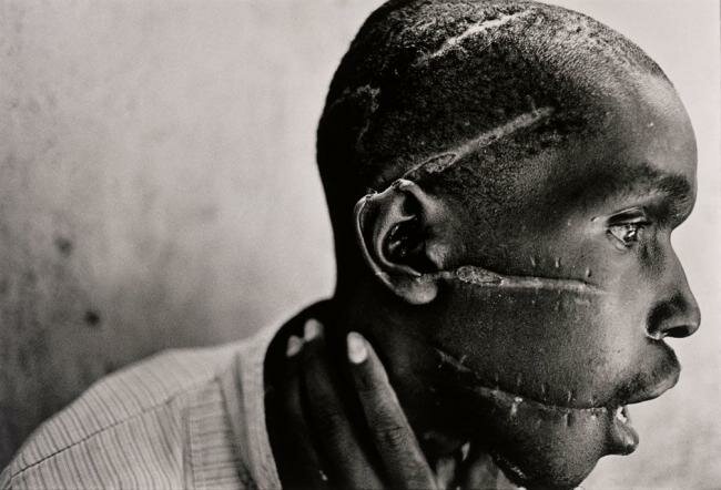James Nachtwey -Man mutilated Rwanda-