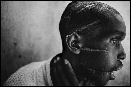 Rwanda, 1994 - Survivor of Hutu death camp.